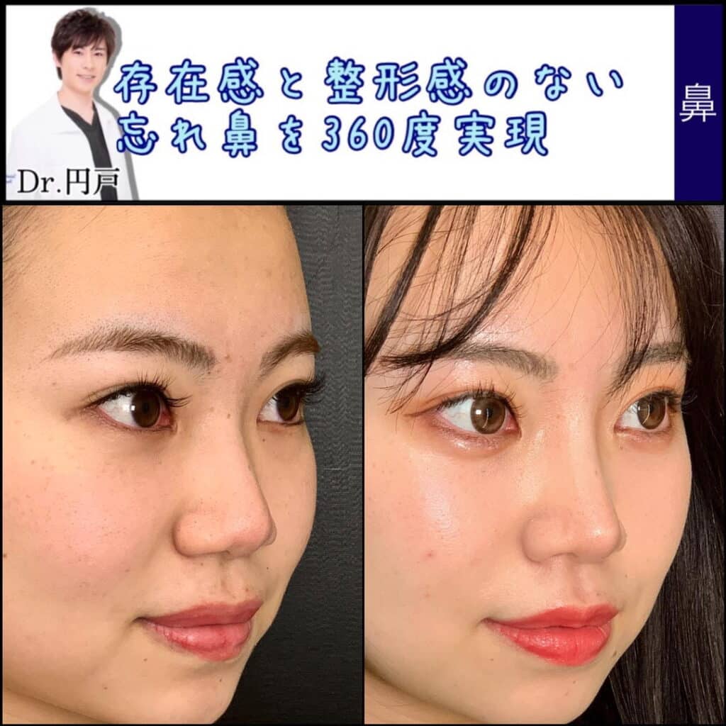 忘れ鼻とは？美人の新常識とされる理由と特徴・作り方を徹底解明
