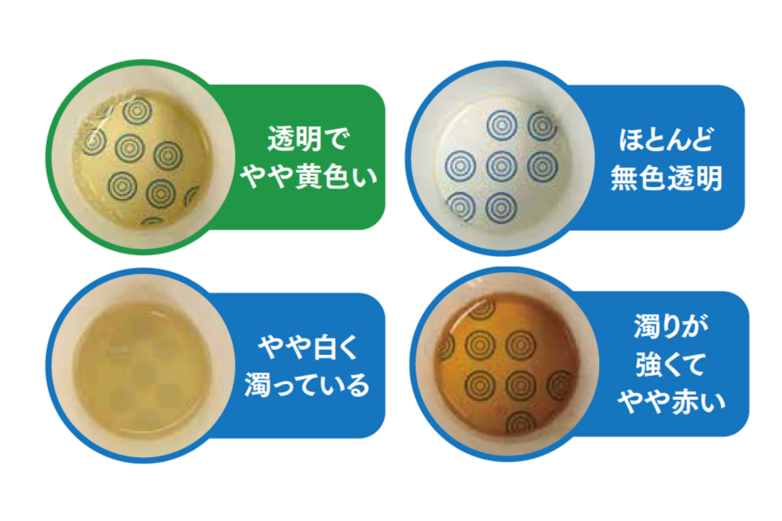 尿が泡立つのは腎臓病のサイン？写真で見る正常と異常の違いと受診目安