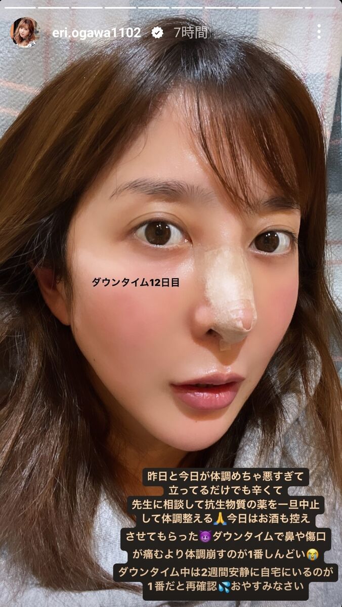 キャバ嬢が整形する理由と総額費用｜売れる顔の特徴を徹底解剖