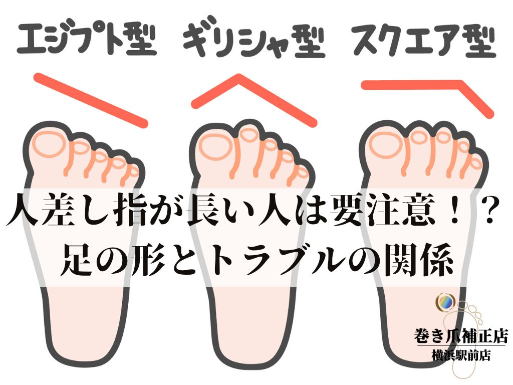 足の人差し指が長い人の特徴とは？出世する噂や性格診断・靴選びの真相