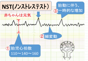 【徹底調査】 ノン ストレス と は 最新ファイル＆画像まとめ #783