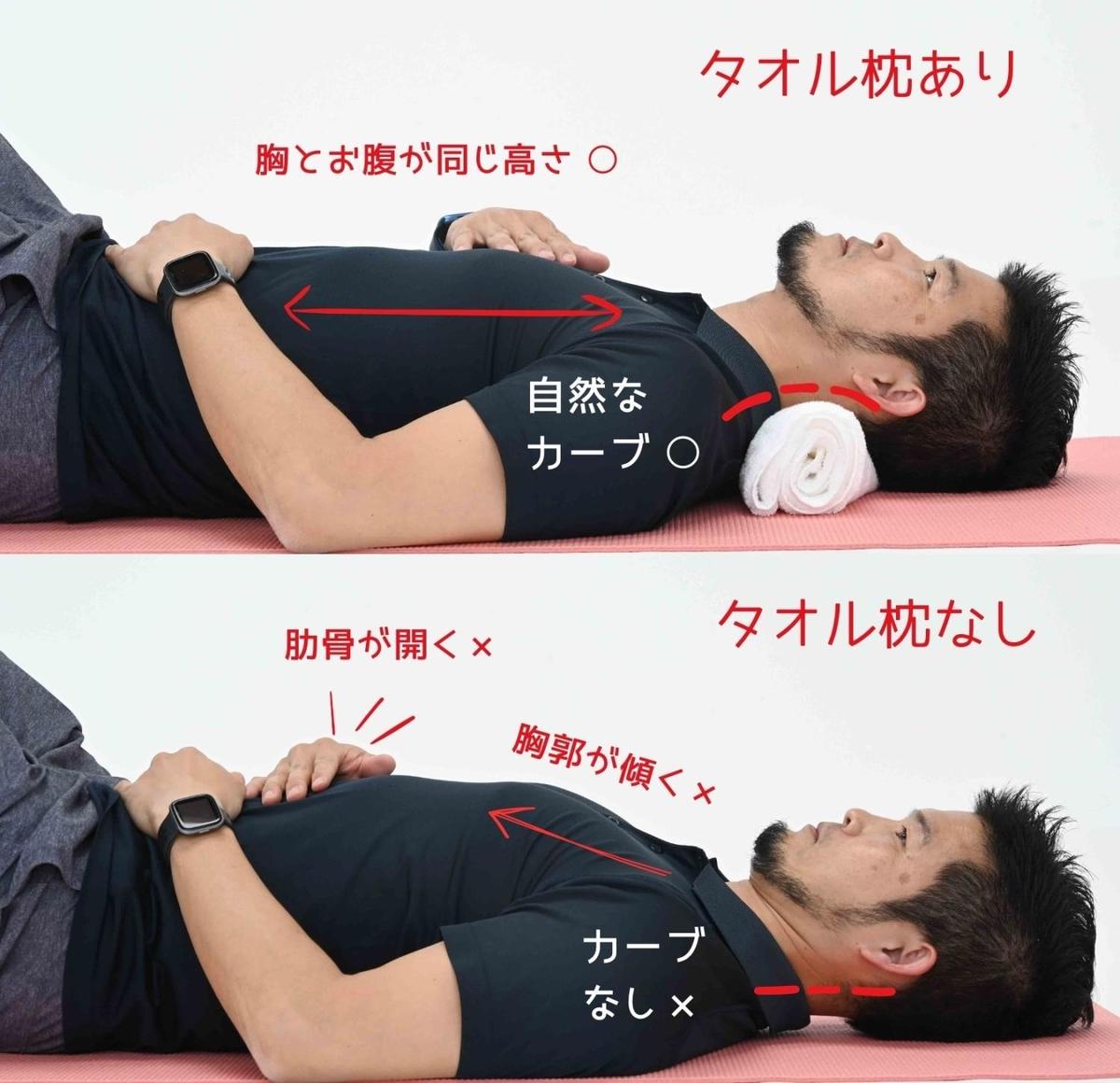 タオルでストレートネックは治る？悪化防ぐ正しいストレッチと作り方