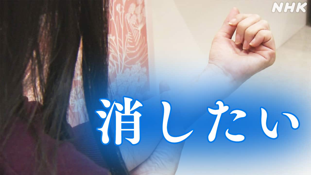 あのちゃんが問いかける「生きづらさ」の真実——傷痕を隠さない表現者が変えた、若者たちの救済と現代のメンタルヘルス【2026年特別寄稿】