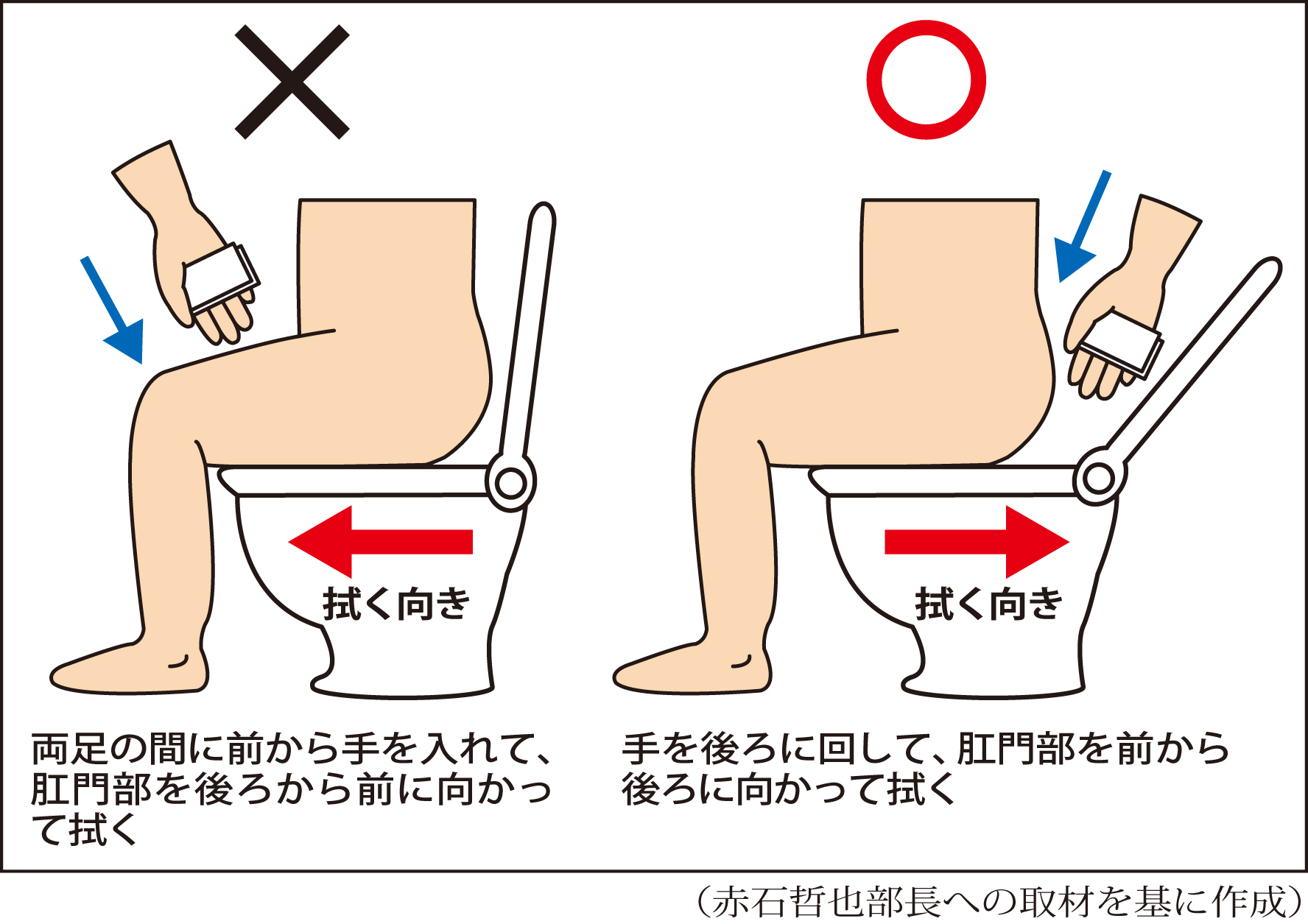 擦りすぎは痔の引き金に！専門医が明かす正しいおしりの拭き方
