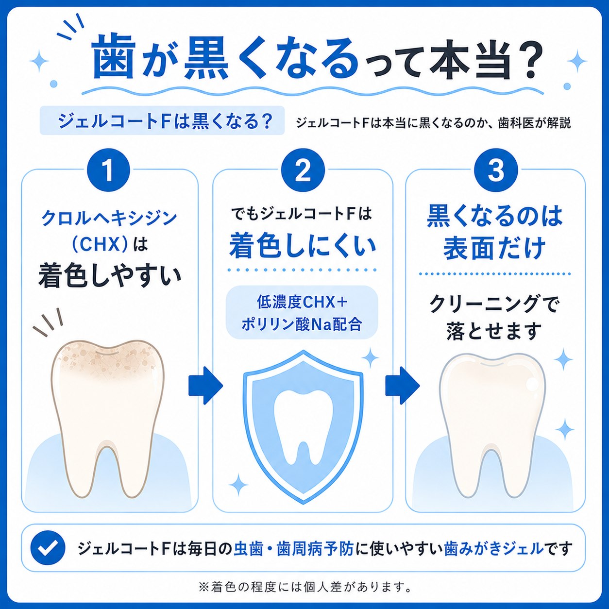ジェルコートFで歯が黒くなる？歯科医が明かす原因と最新の対策法