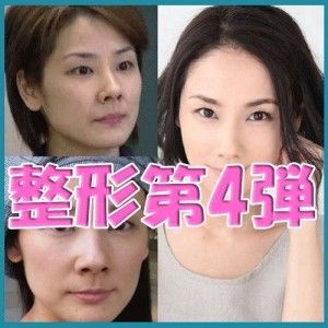 【真相】 目頭 切開 やりすぎ 芸能人 経歴＆学歴まとめ 2026 #860