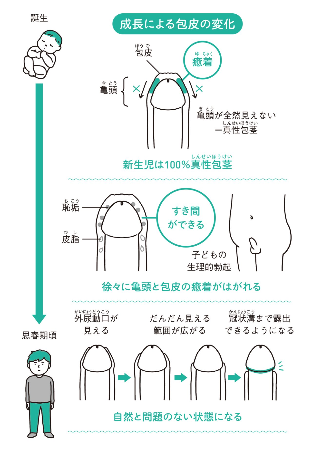 男の子の皮をむく時期はいつ？小児科医が教える正しいケアと危険な誤解