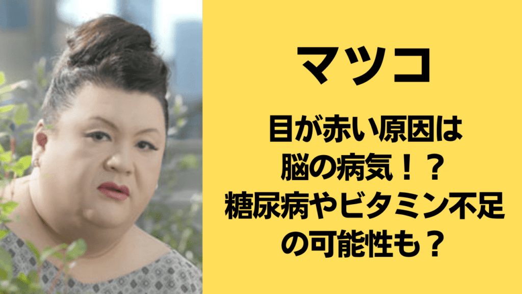 マツコ・デラックス重病説の真相と現在｜めまい休養の経緯と引退の噂