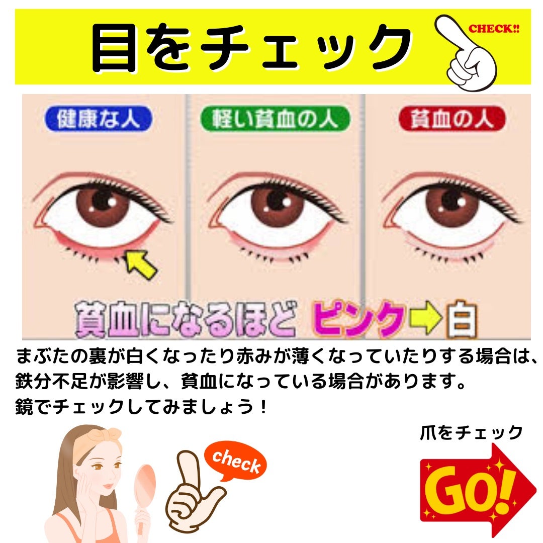まぶたの裏でわかる貧血サイン！正常色との見分け方と隠れ鉄分不足の真実