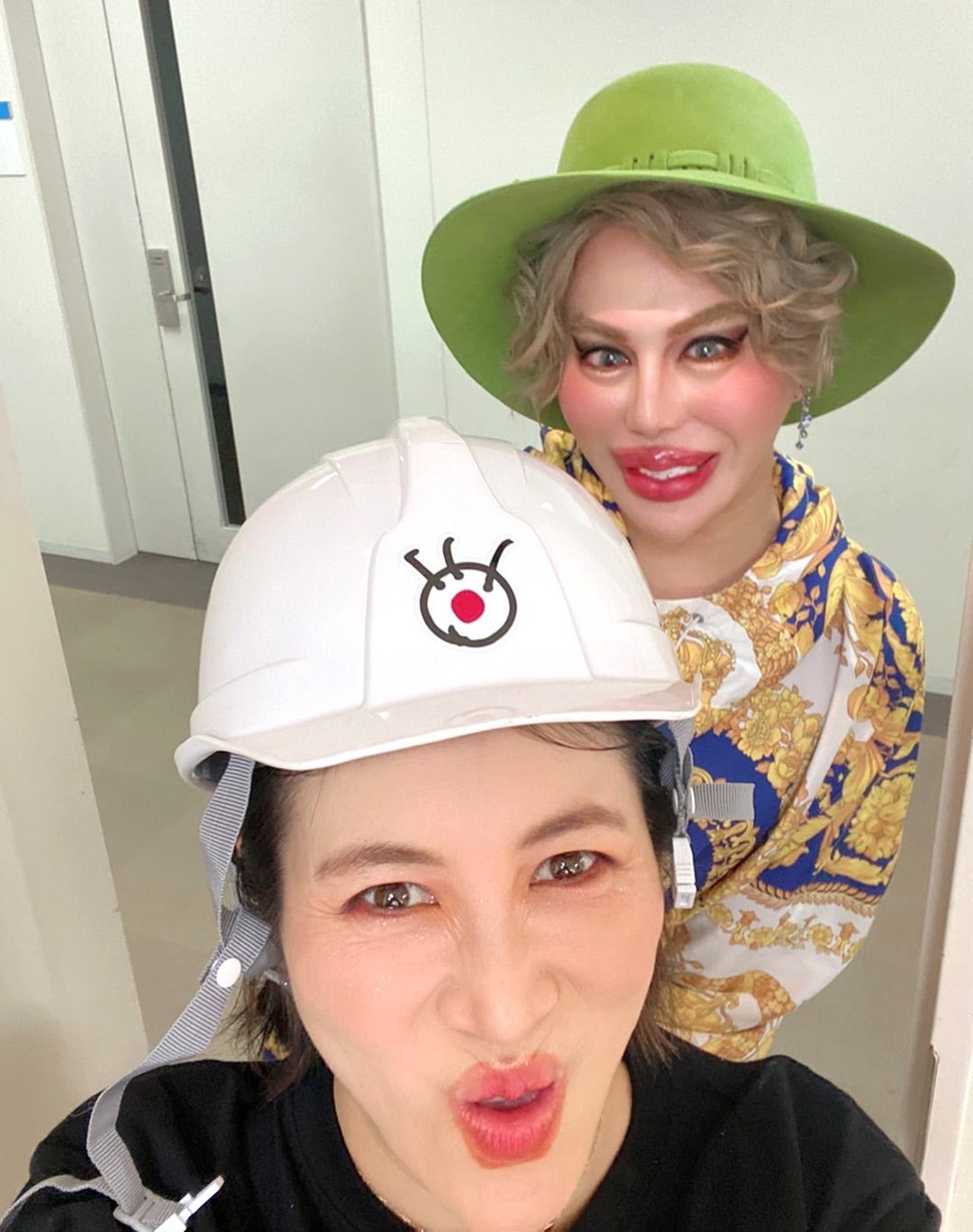 ミラクルひかるの整形疑惑は本当？昔の写真と現在を比較検証した衝撃真相