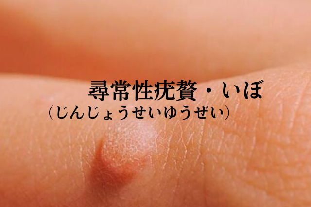 尋常性白斑は治るのか？原因と初期症状・最新の保険適用治療を徹底解説