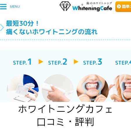 【Wiki風】 ホワイトニング カフェ 口コミ 経歴＆学歴まとめ 2026 #612